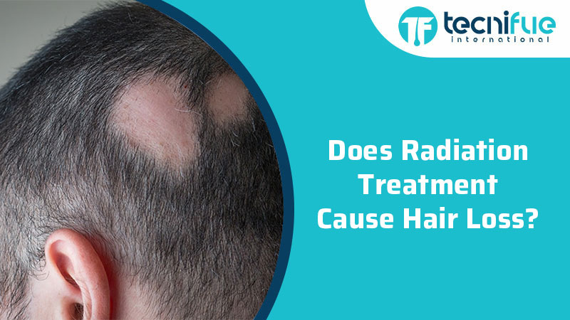 Does Radiation Treatment Cause Hair Loss? » TecniFUE Best Hair Transplant