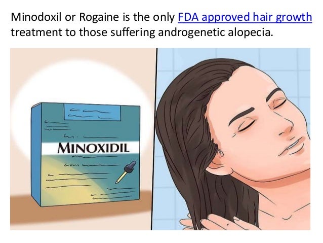 Does Rogaine Stop Hair Loss?