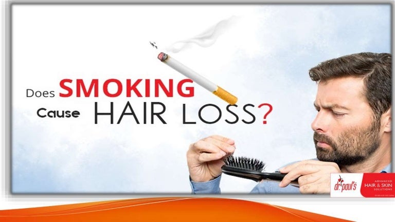 Does Smoking Cause Hair Loss