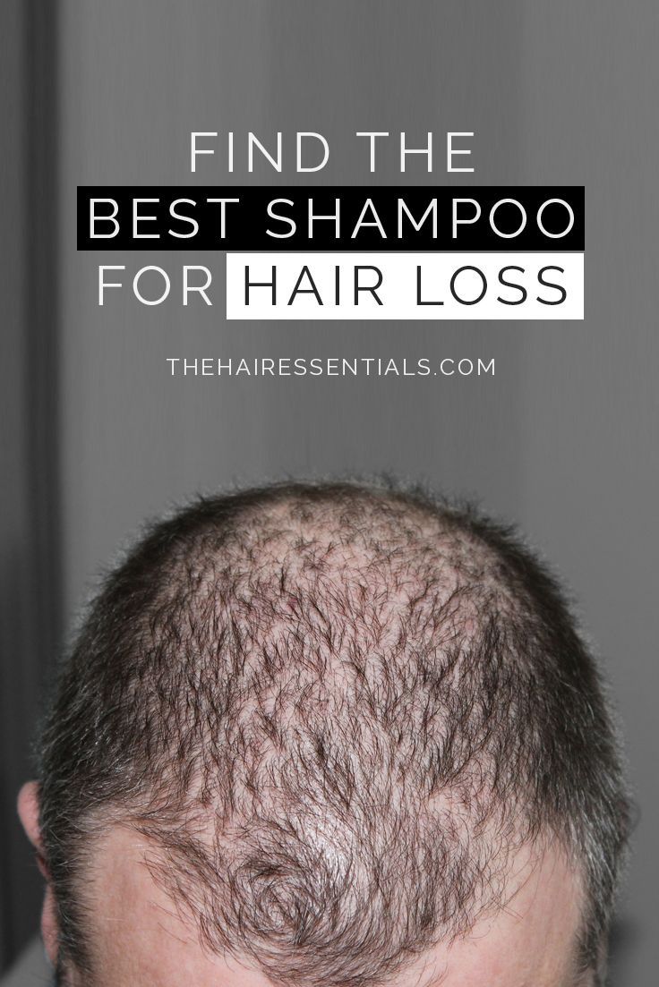 FInd the Best Shampoo for Hair Loss and Regrow your Hair ...