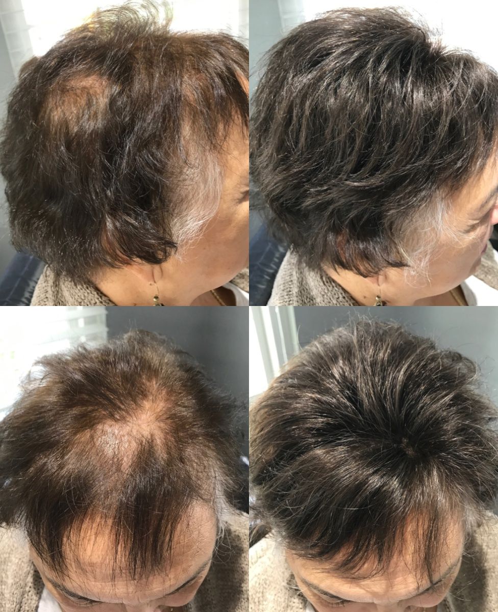 Fix Thinning Hair with Invisablend