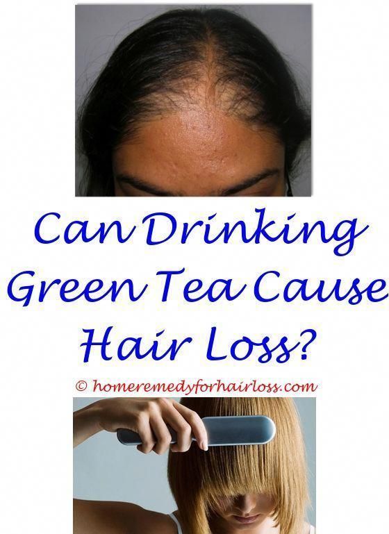 folfox chemo hair loss can hair loss due to dandruff.home ...