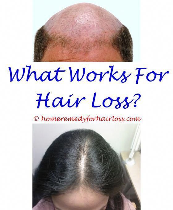 gnc ultra nourish hair loss