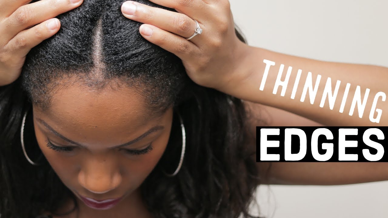 Growing Back THINNING EDGES (5 SIMPLE TIPS)