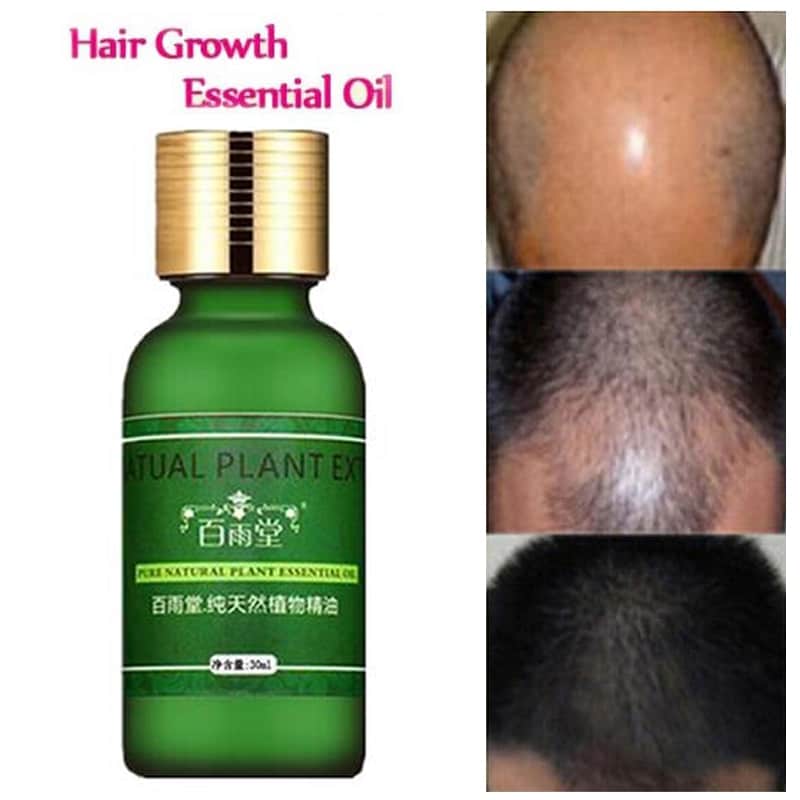 Hair Care Hair Growth Essential Oils Essence Original Authentic 100% ...