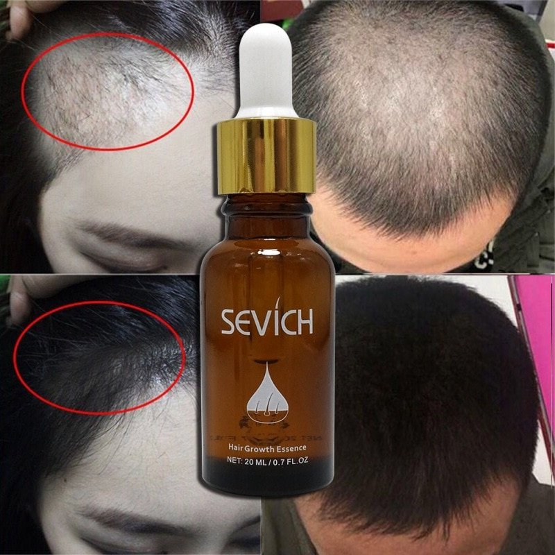Hair Care Hair Growth Essential Oils Essence Original Authentic Hair ...