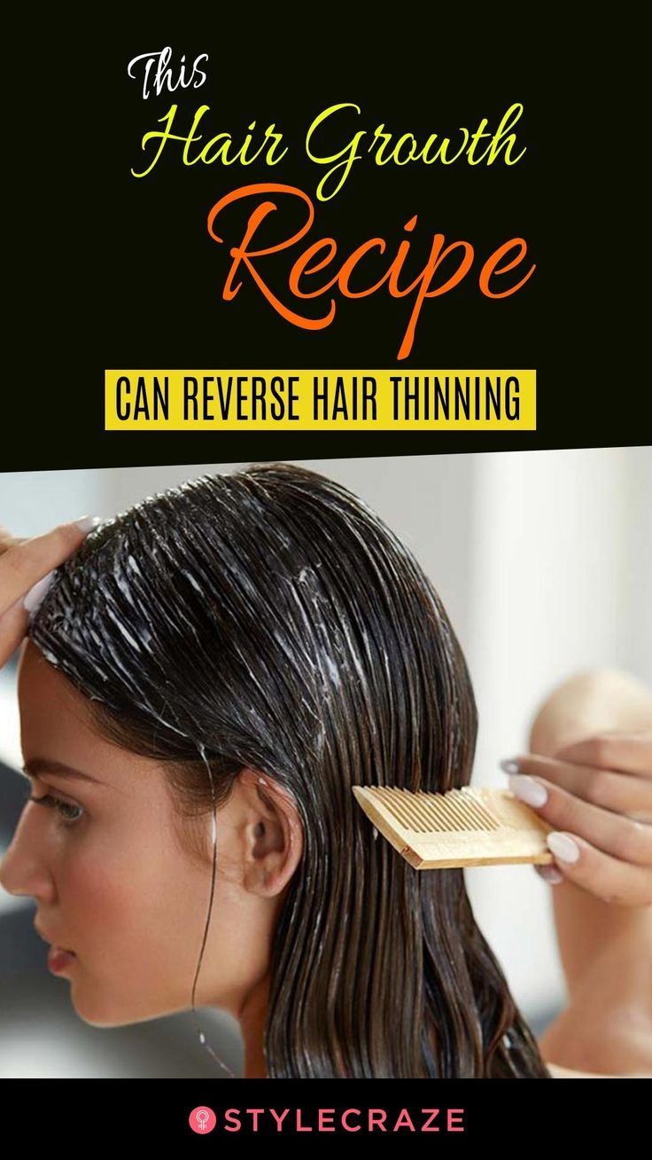 Hair care : This Hair Growth Recipe Can Reverse Hair ...