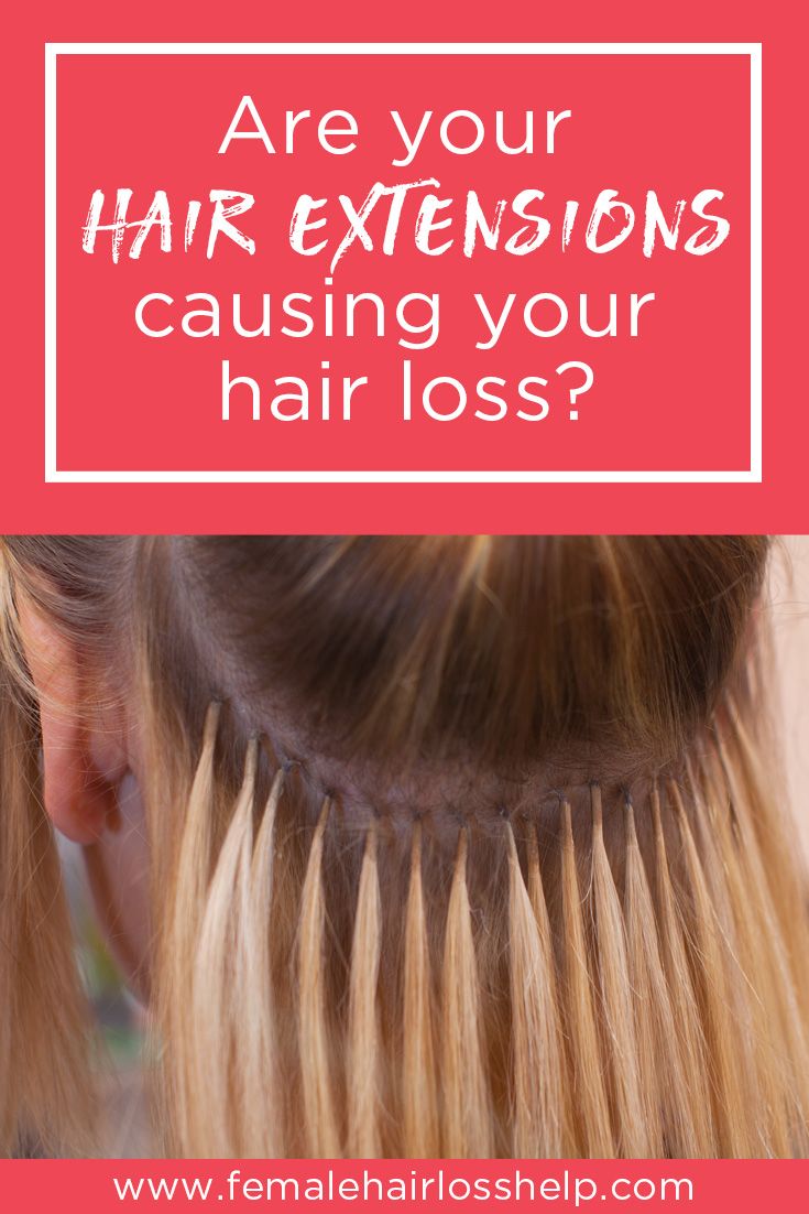 Hair Extensions Causing Hair Loss