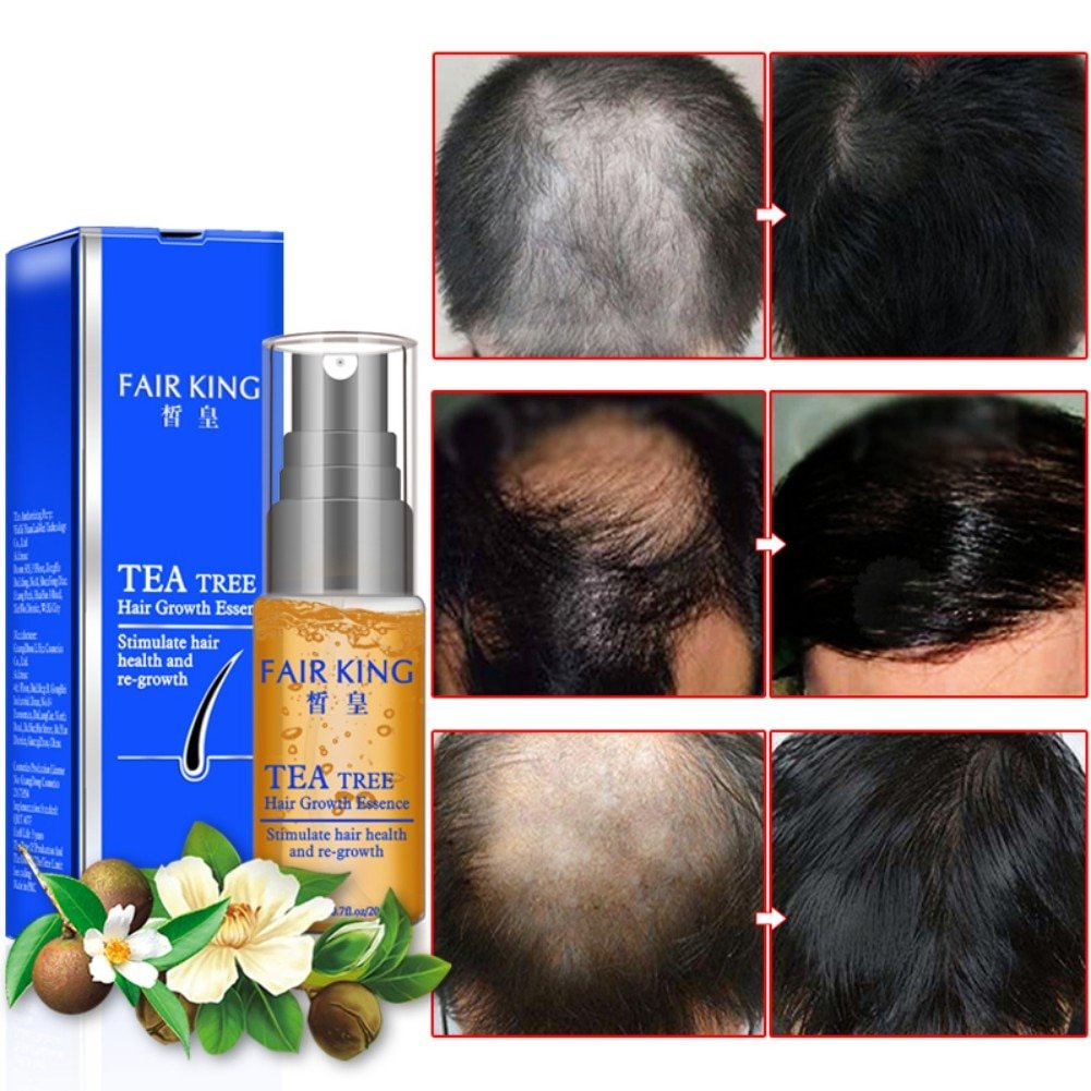 Hair Growth Essence Product Treatment Anti Hair Loss ...