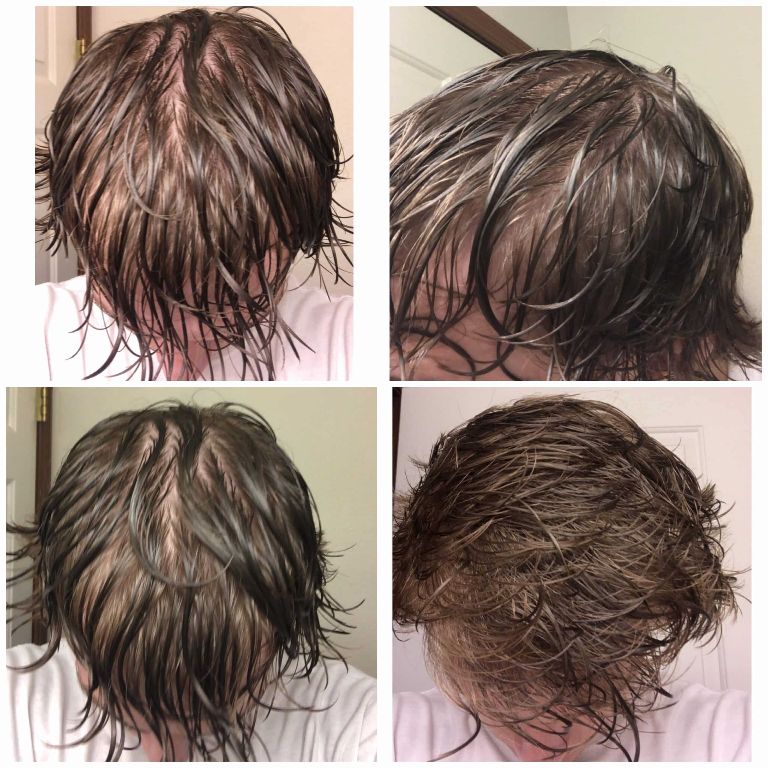Hair has gotten more thin the last few months. When hair is wet/soaked ...