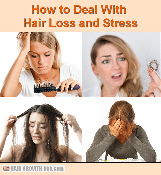 Hair Loss and Stress And How To Deal With It