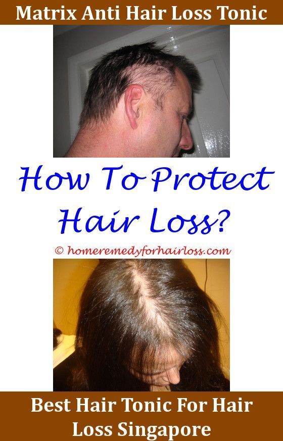 Hair Loss Androgen Sensitivity Hair Loss,Hair Loss low ...