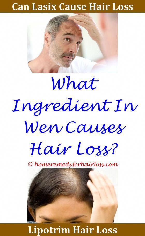Hair Loss Best Doterra Oils For Hair Loss Hair Loss Due To ...