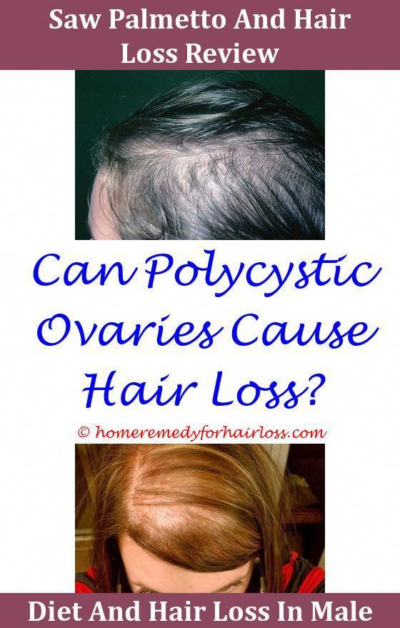 Hair Loss Can Kidney Diseas Cause Hair Loss Stem Cell ...