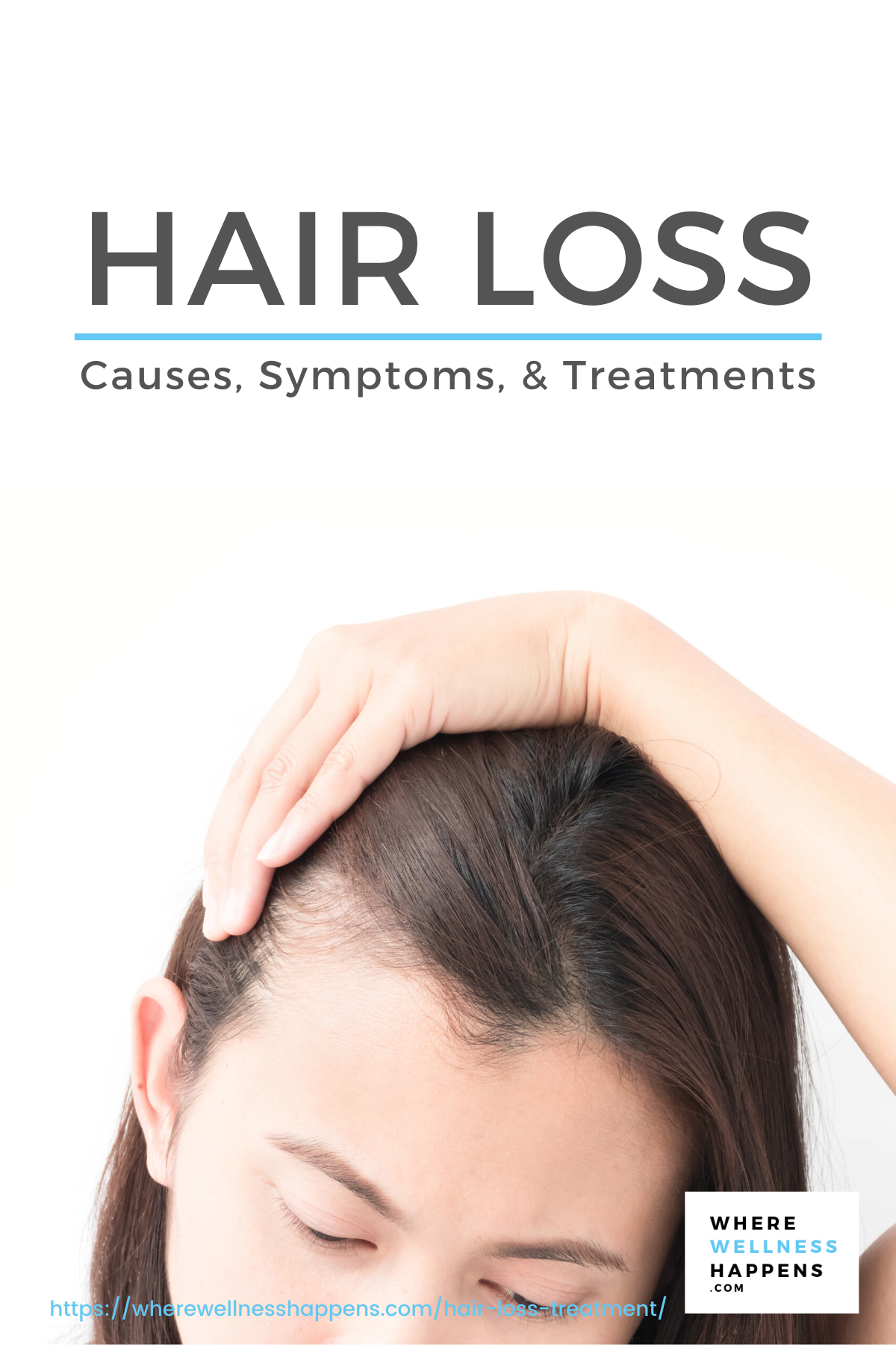 Hair Loss: Causes, Symptoms and Treatments