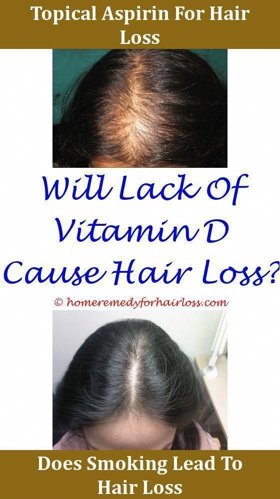 Hair Loss Celiac Disease Cause Hair Loss Can U Stop Hair ...
