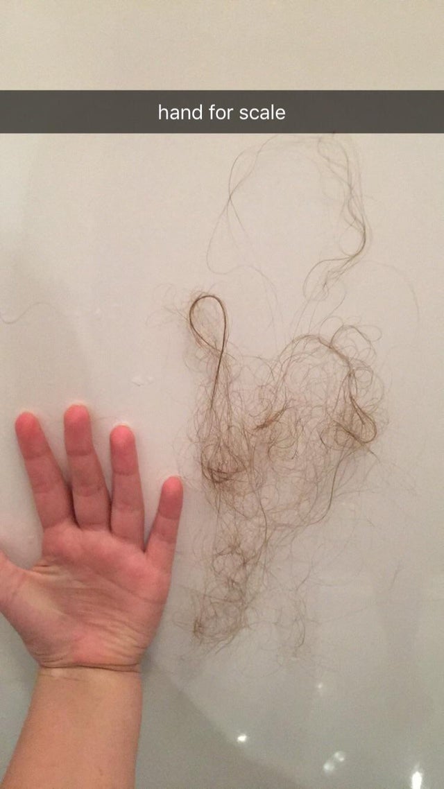 Hair loss?? Do you guys lose this much hair?? this was ...