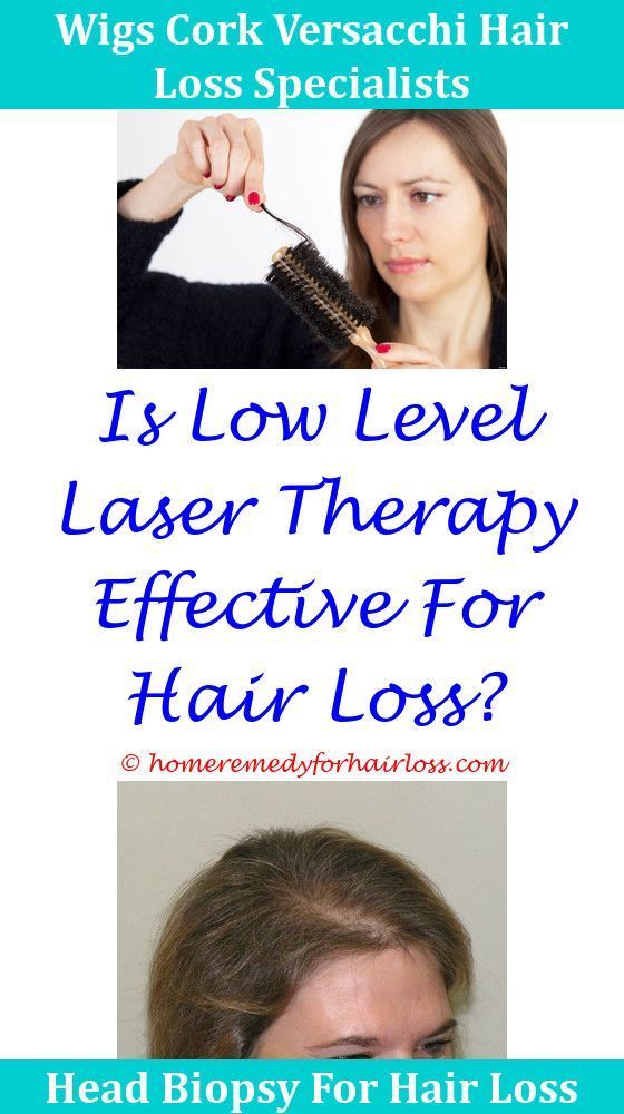 Hair Loss Excessive Hair Loss In Women What Causes Hair ...