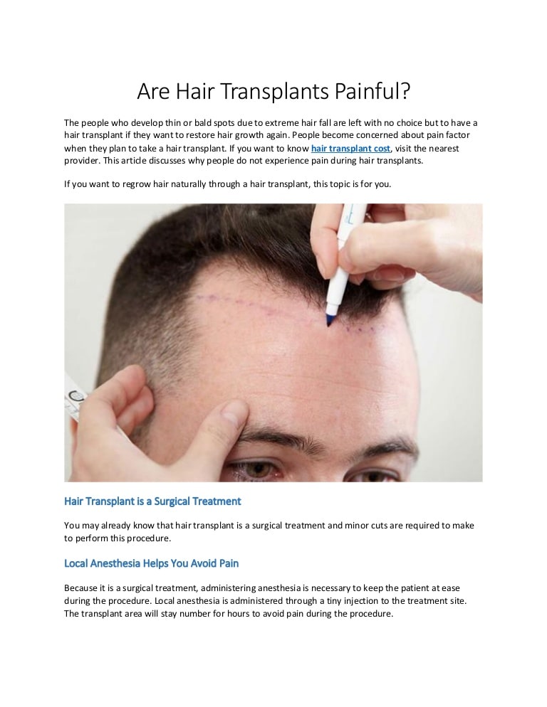 Hair Loss From Anesthesia : All About Hair Transplant ...