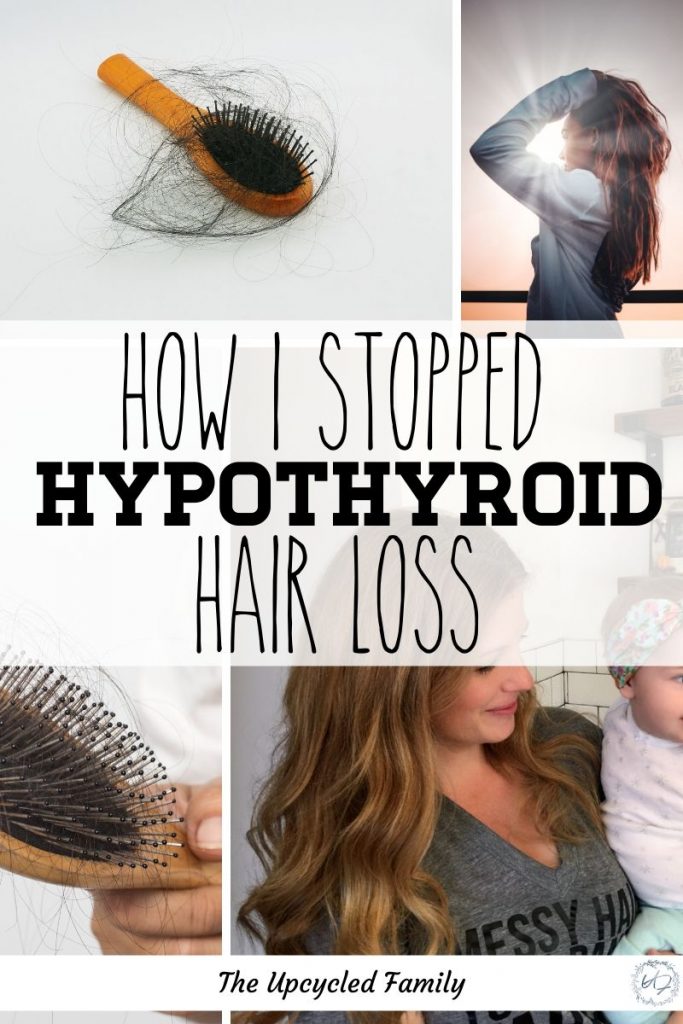 Hair Loss Hypothyroid : Stop Hair Loss Hypothyroidism ...