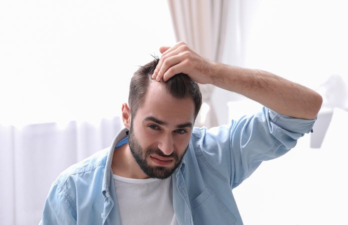 Hair Loss in Men  Causes and Treatments