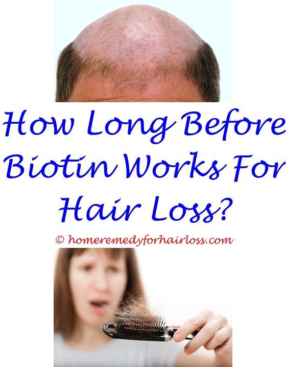 Hair Loss lack of magnesium and hair loss