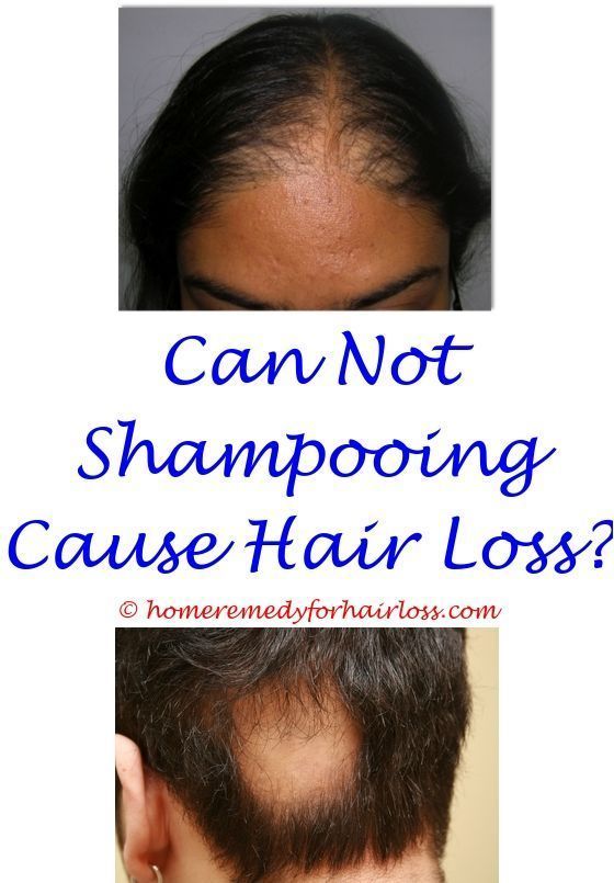 Hair Loss low vitamin b12 and hair loss