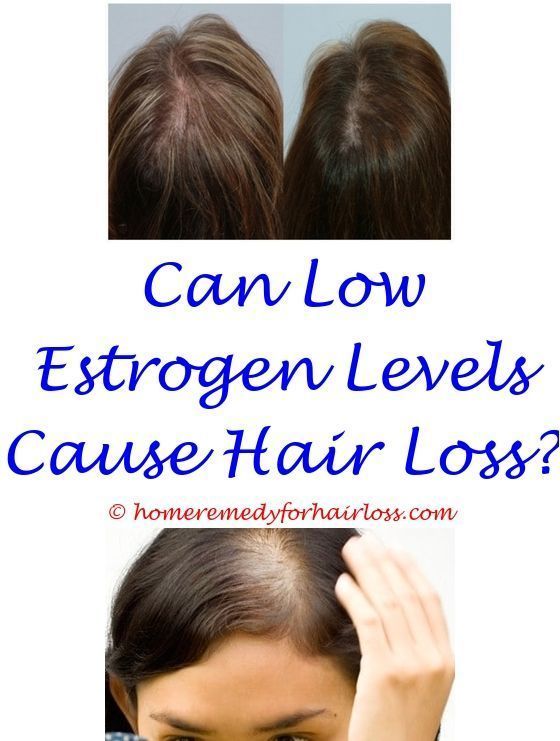 Hair Loss malt vinegar hair loss