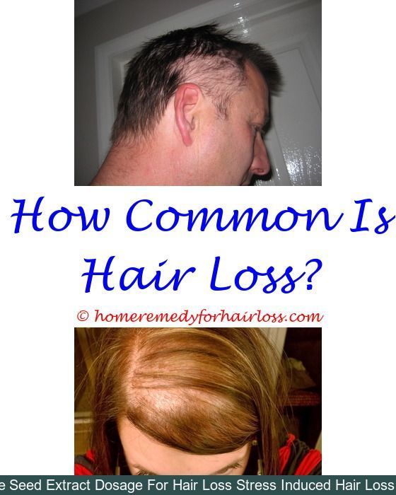 Hair loss may be unusual if you are shedding greater than 100 hairs a ...