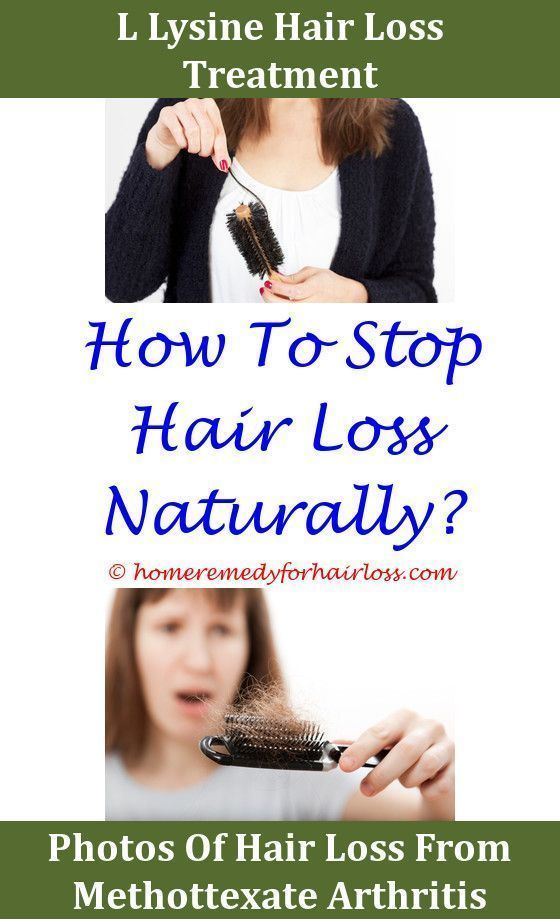 Hair Loss Menstrual Irregularities,reverse hair loss naturally.Hair ...