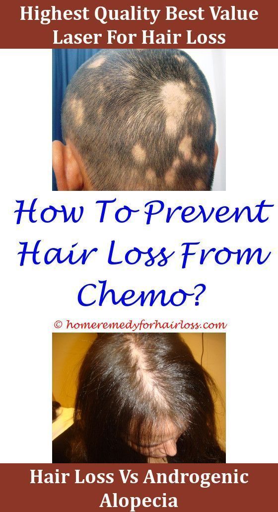 Hair Loss Organic Shampoo To Stop Hair Loss,Hair Loss what ...
