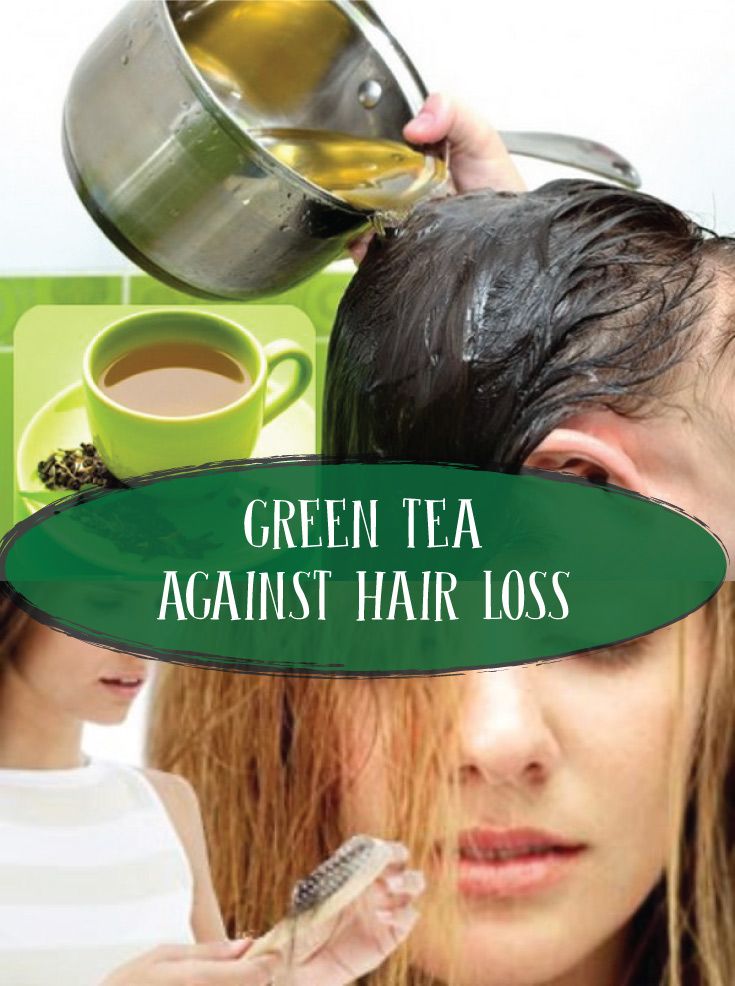 Hair Loss Remedies That Work : Top Hair Loss Causes + the ...