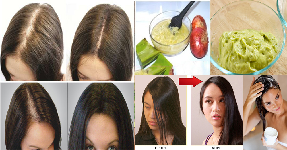 Hair Loss Treatment fast naturally at home