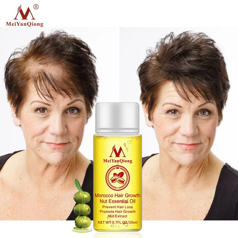 Hair loss treatment product, hair growth products online