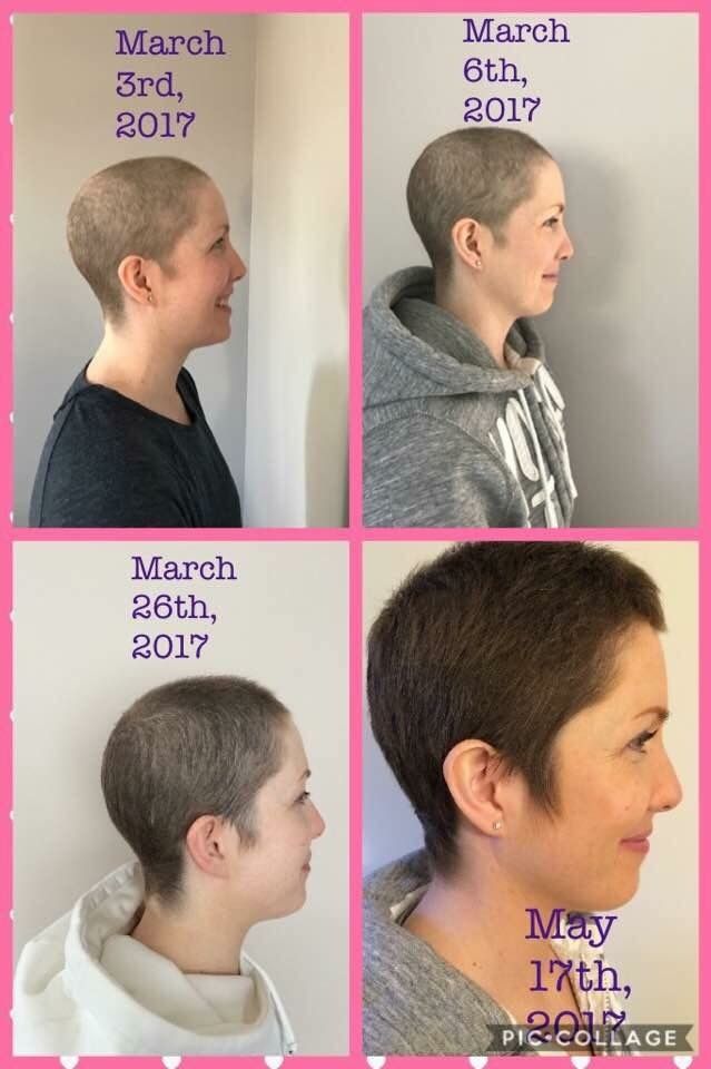 Hair regrowth after Chemo Hairbyclaire.mymonat.com