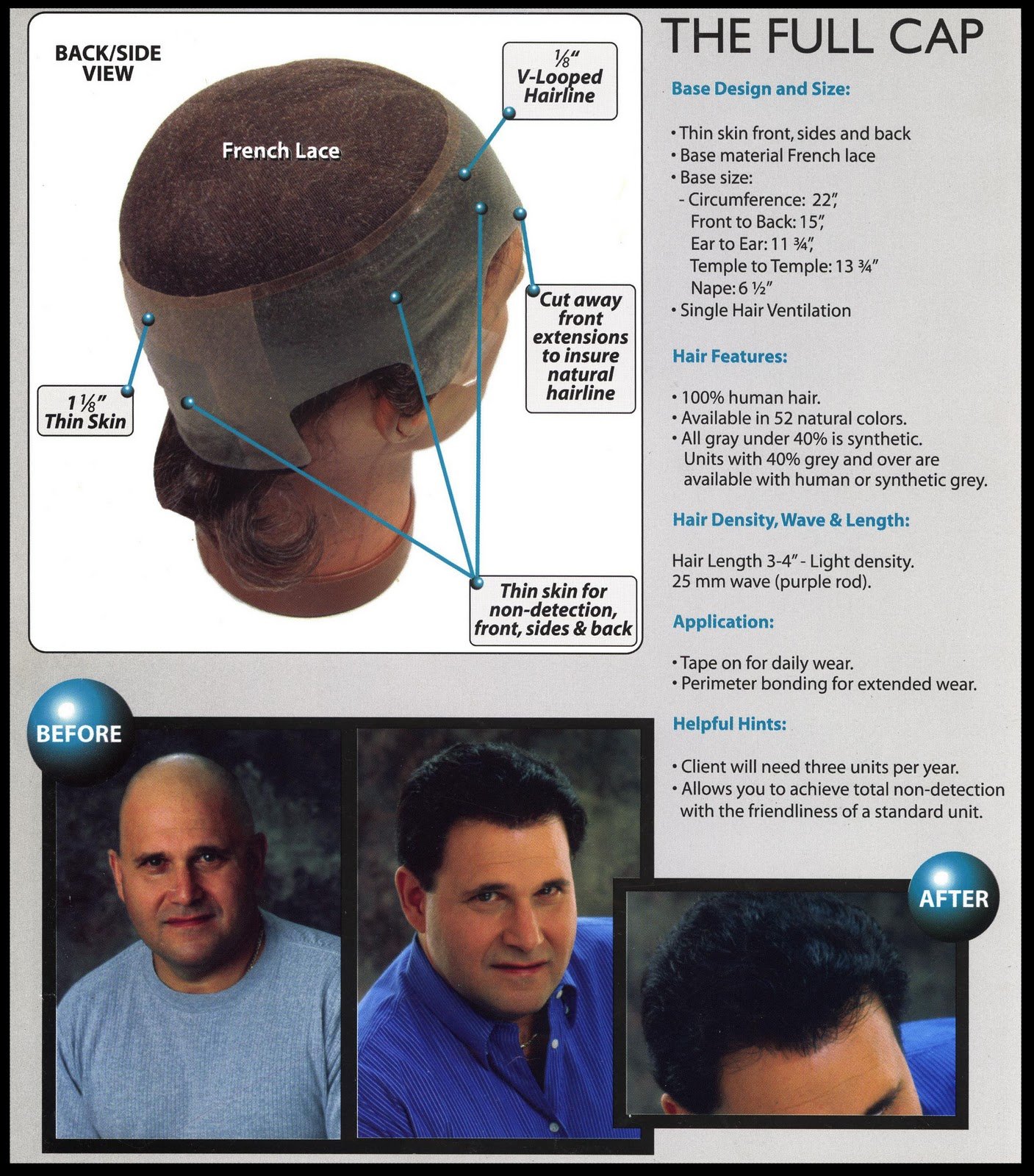 Hair Replacement For Men: Chemotherapy Hair Loss Solution For Men