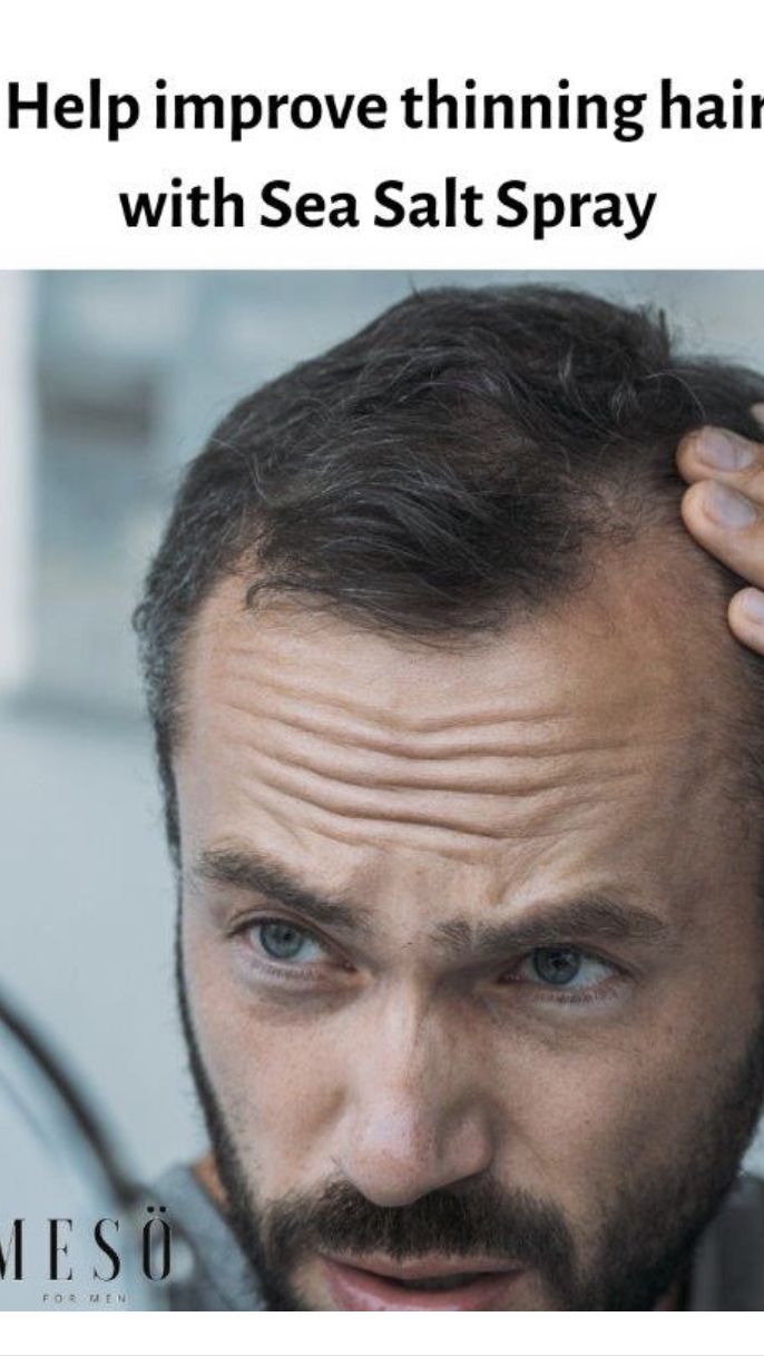 Help for thinning hair: An immersive guide by Meso For Men