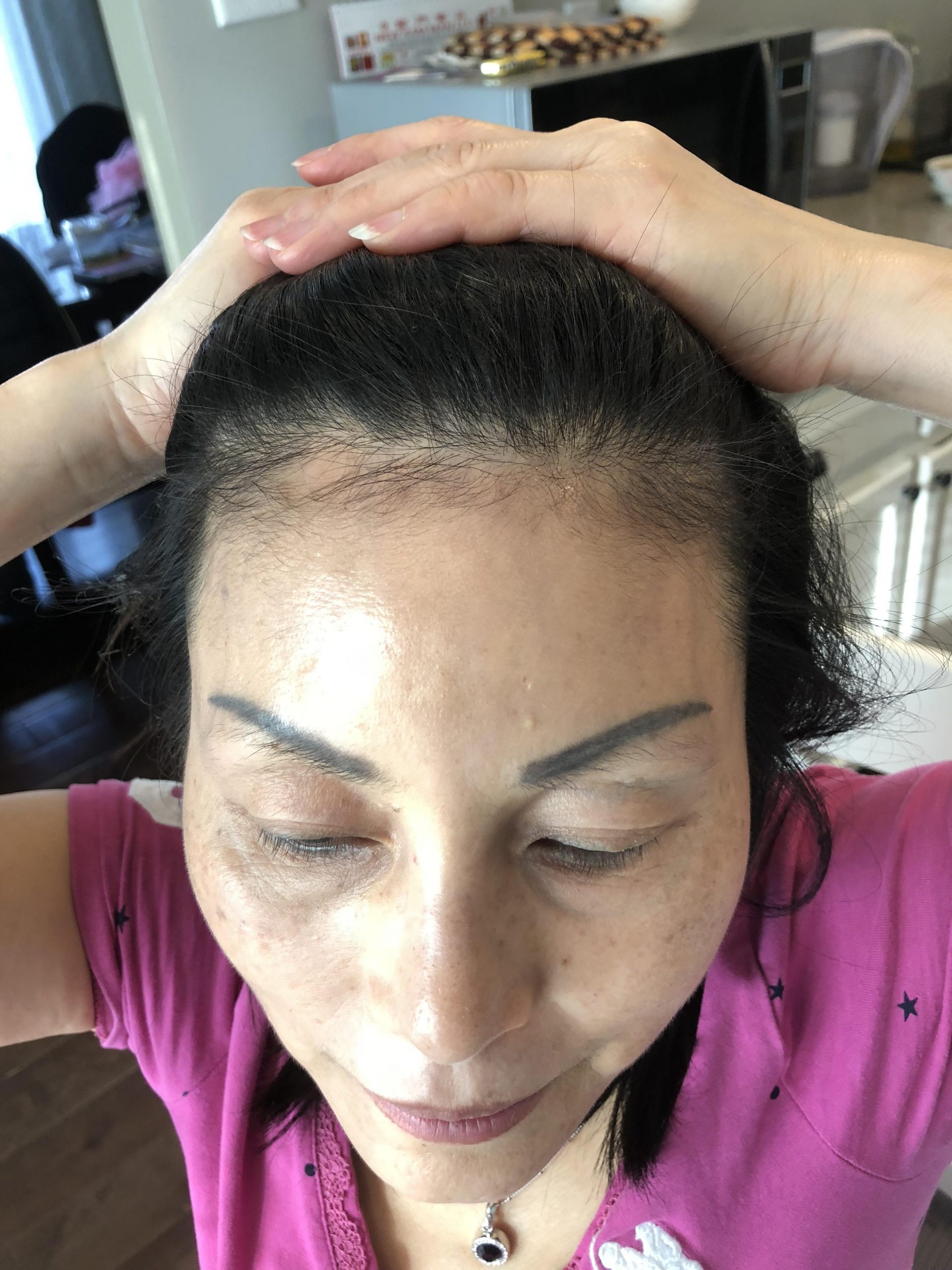 Help! Hair loss and bald spots unaffected by anything Ive ...