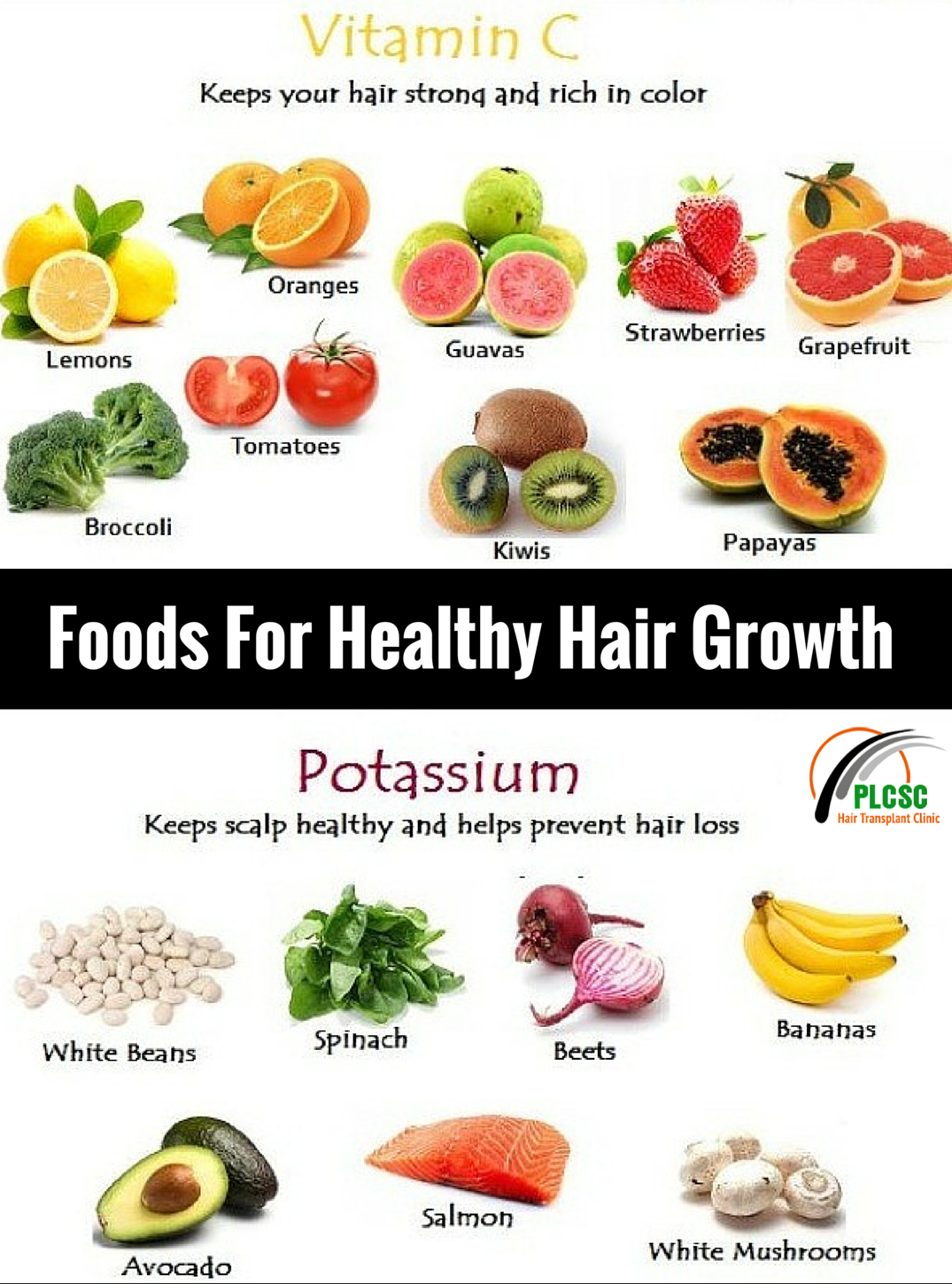 Here are some foods that can help prevent hair loss. Take care. # ...
