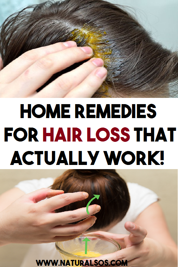 Home remedies for hair loss that actually work!