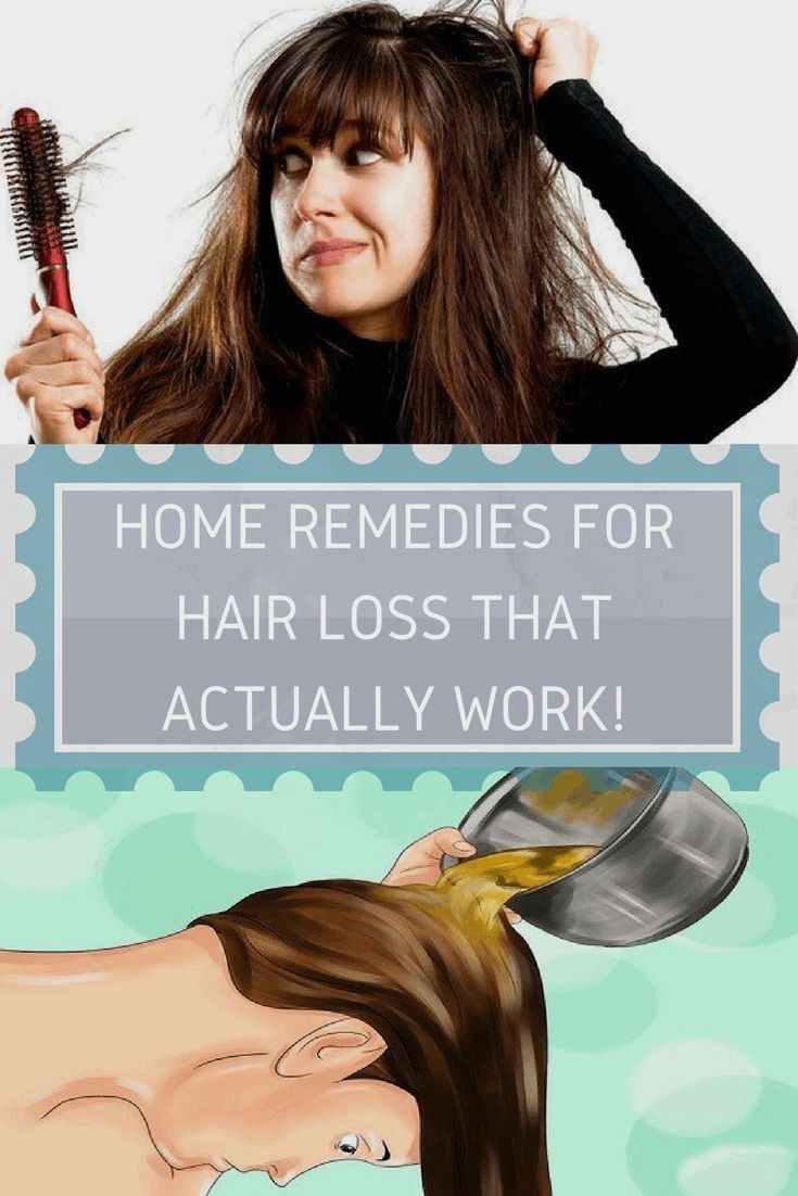 HOME REMEDIES FOR HAIR LOSS THAT ACTUALLY WORK! #health ...