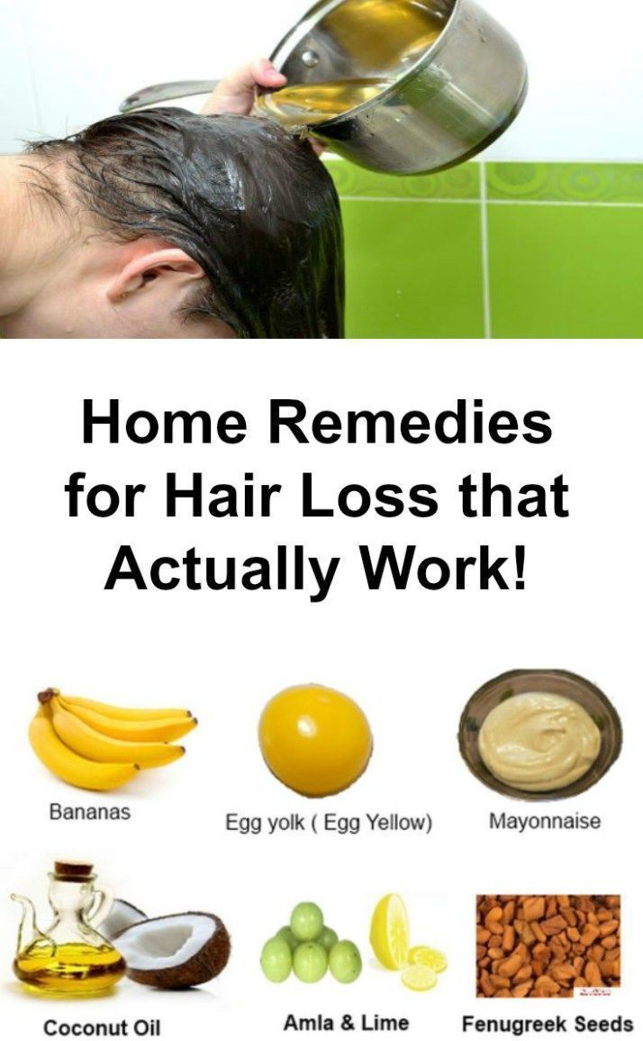 HOME REMEDIES FOR HAIR LOSS THAT ACTUALLY WORK! # ...