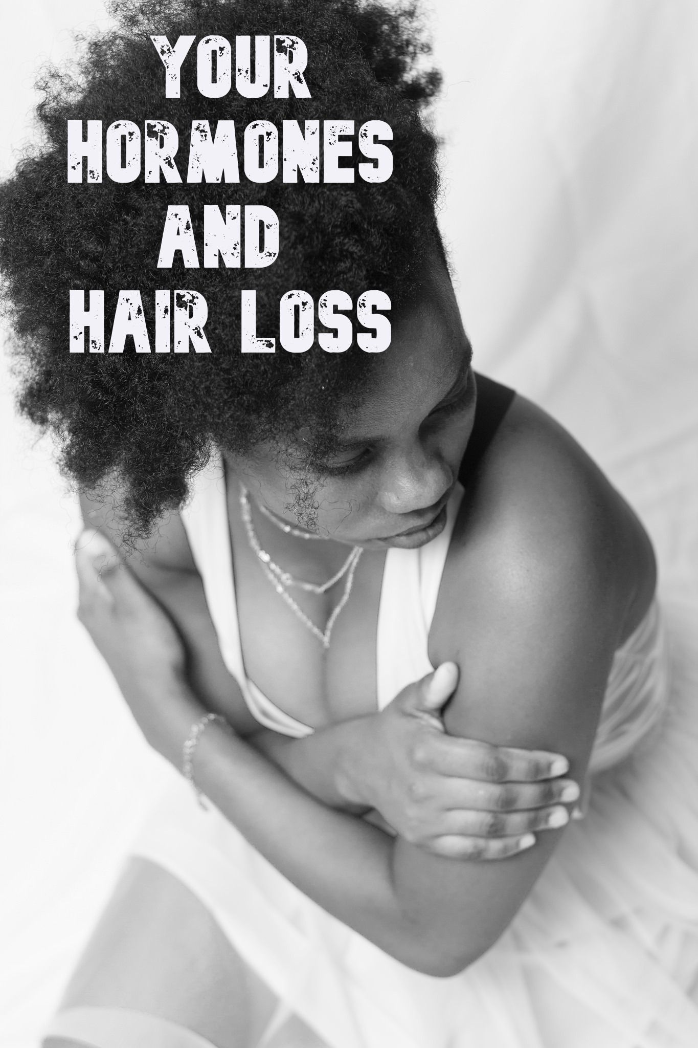 HORMONES AND HAIR LOSS
