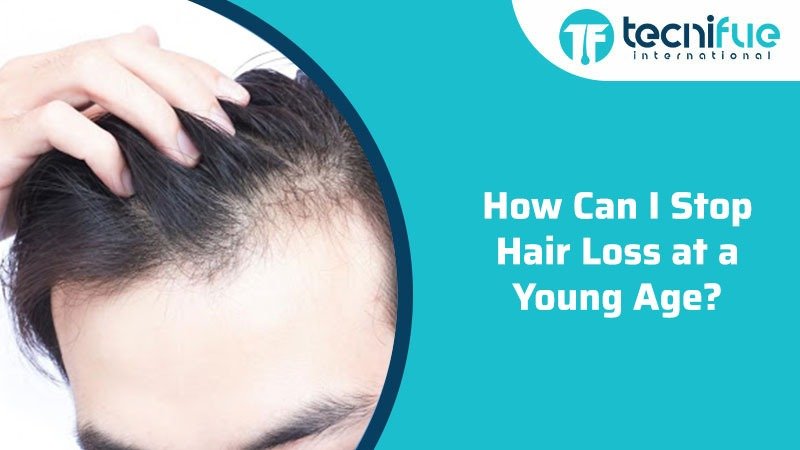 How Can I Stop Hair Loss At A Young Age? » TecniFUE Best Hair