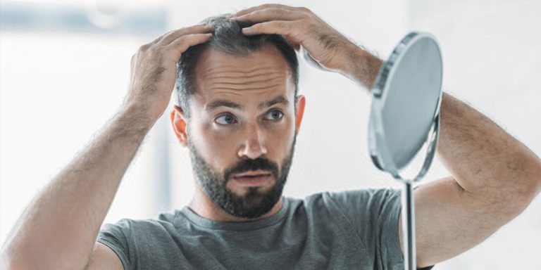 How Can You Prevent Hair Loss? 10 Ways To Prevent Hair ...
