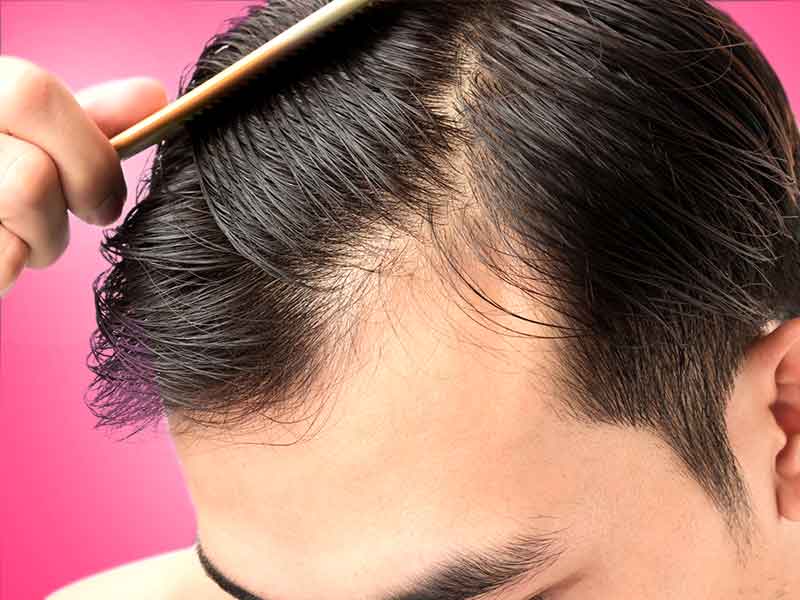 How can you prevent hair thinning