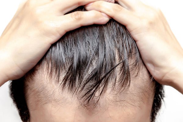 How Can You Tell If Your Hair Is Thinning