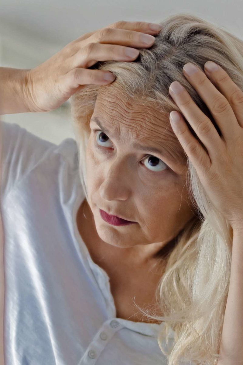 How do ferritin levels affect hair growth?