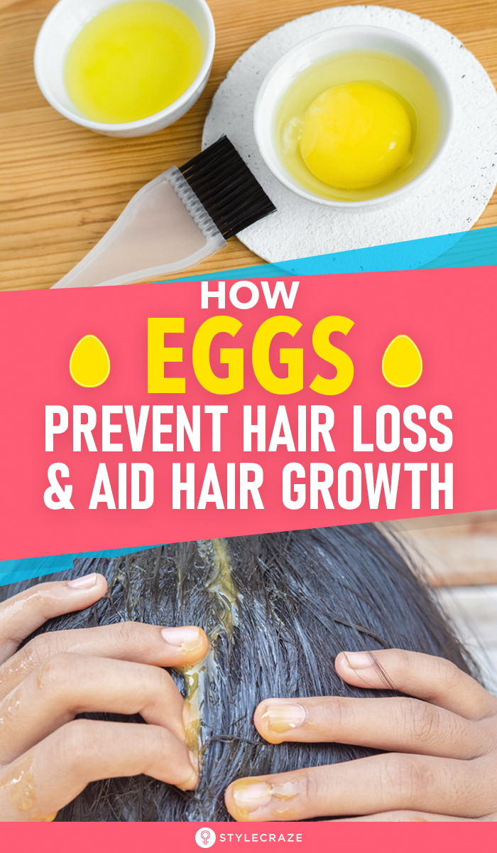 How Eggs Prevent Hair Loss And Aid Hair Growth in 2020 ...