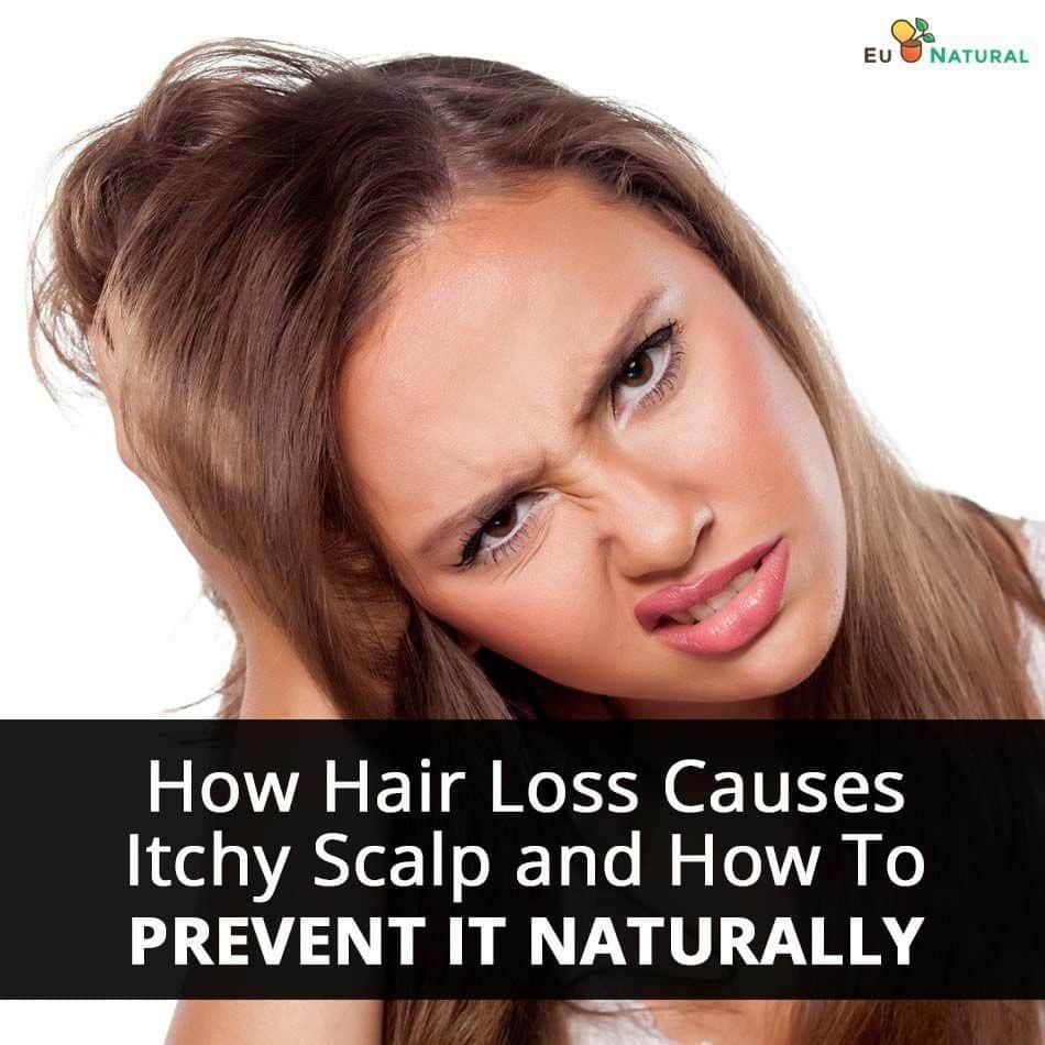 How Hair Loss Causes Itchy Scalp and How To Prevent It Naturally # ...